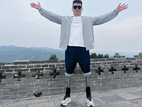 双腿肢友故事之大佳，乐观人生不设限！