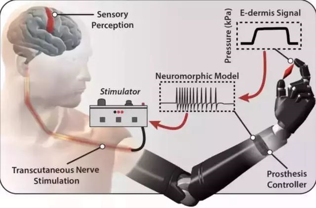 让假肢也有触觉，只需加上这个……(图2)