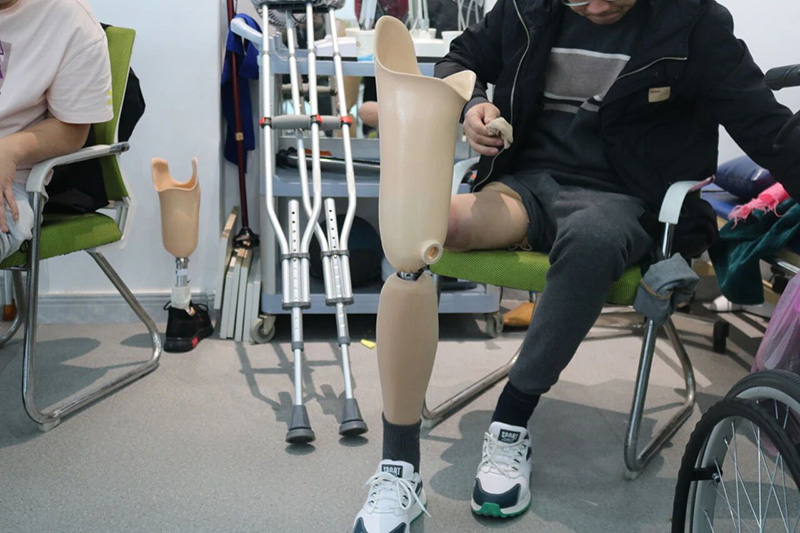 糖尿病足截肢者专属：如何兼顾伤口管理与假肢适配？